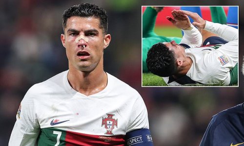 Cristiano Ronaldo suffers HORROR injury in Portugal's thrashing of Czech Republic with the Man United star's face covered in blood after a clash with keeper Tomas Vaclik... but the forward still managed the full 90 minutes