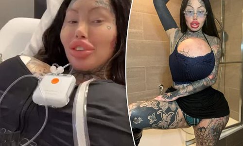 Surgery Addicted Model Has 38j Implants Removed And Vaginal