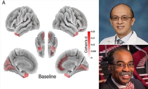 Children under the age of 10 who get less than nine hours of sleep each night develop less brain matter - and are more likely to suffer from mental health and memory issues, study finds