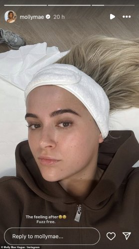 Molly-Mae Hague grows ‘full beard’ as she warns fans over cosmetic treatment