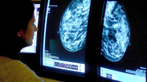 Breast cancer breakthrough as scientists discover potential way they could kill 'hibernating' tumour...