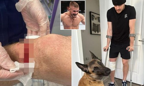 Nathaniel Wood forced out of all-British battle with Lerone Murphy at UFC 286 in London as 'The Prospect' shares a photo of a 'sliced knee' sustained in a 'freak accident' in training