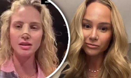 Meghan King is over the moon as she gushes about the results of plastic surgery on her nose and breasts
