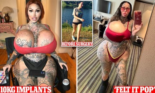 Surgery-addicted model's 38J breast implant BURSTS leaving her with a lopsided 'alien uniboob' - as fans beg her to stop going under the knife: 'Your body is literally telling you to stop'