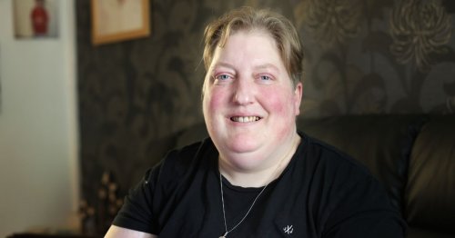 Llandudno woman shares what it’s like to live with schizophrenia