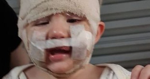 Tot left with horror injuries after 'perfect' family dog tried to rip face off
