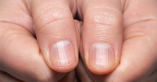 Type 2 diabetes symptoms on your nails - warning signs and when to seek help
