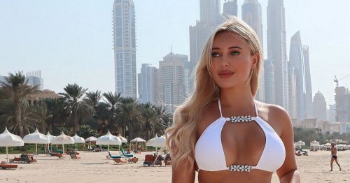 TOWIE's Amber Turner claims combat with SAS co-stars caused implant rupture