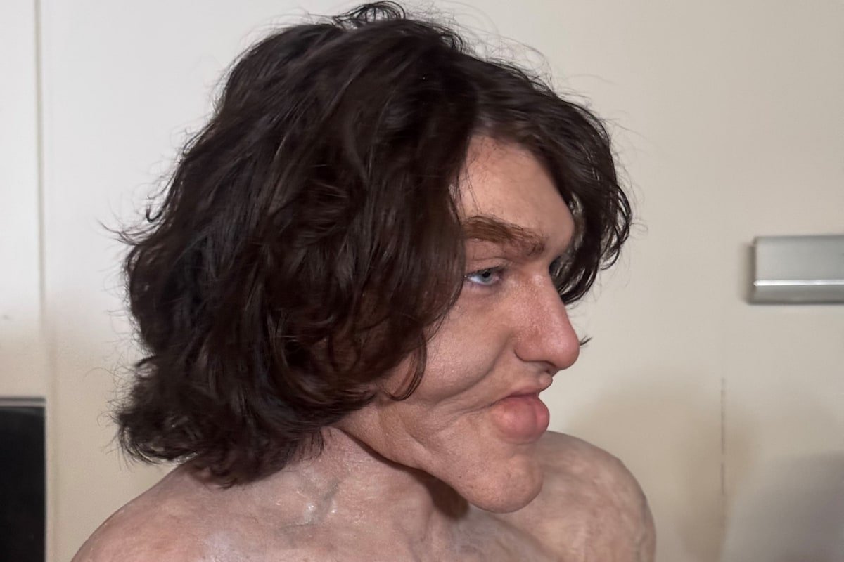 Looksmaxxing: The film giving male beauty hacks the body horror treatment