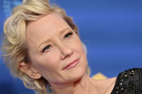 Anne Heche “Not Expected To Survive” After Severe Brain Injury, Will Be Taken Off Life Support