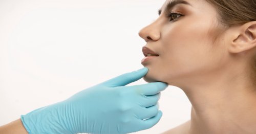 ¿Qué hace la radiofrecuencia en la cara? Todo sobre el lifting facial sin cirugía