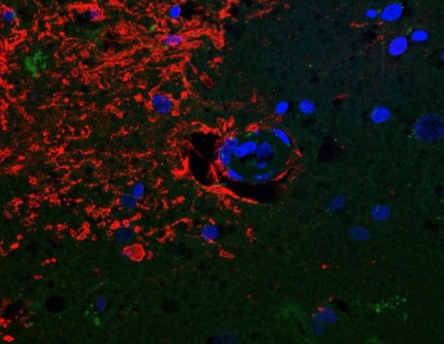 Major finding in human anatomy has implications for many brain diseases, including Alzheimer’s