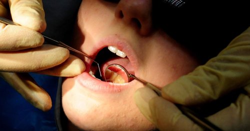 No plans for more NHS dentist surgeries in Derby despite city's dental crisis