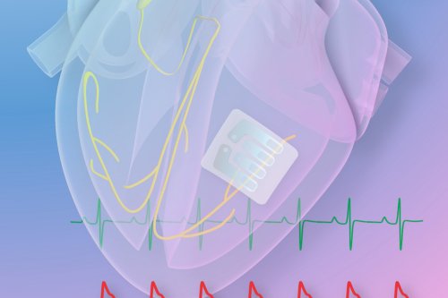 Transparent Graphene ‘Tattoo’ Can Sense Irregularities, Stimulate The Heart - DesignTAXI.com