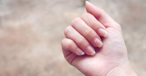 Krankheiten an den Fingernägeln erkennen: 10 Zeichen