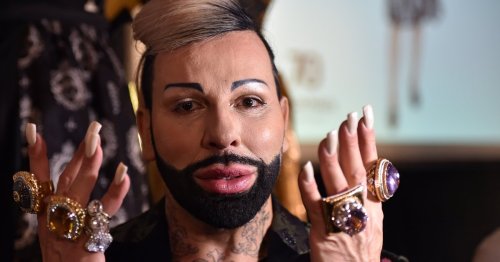 Nach Beauty-Eingriffen: Harald Glööckler zeigt brandneues Gesicht!