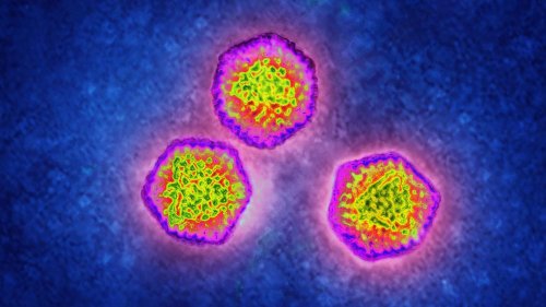 Häufung von Hepatitis-Fällen bei Kindern - Hepatologe: „Es ist nicht der Zeitpunkt, wo wir Alarm schreien müssen“