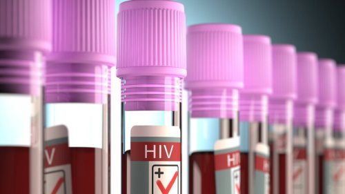 Neue Bezeichnung für HIV für weniger Stigmatisierung