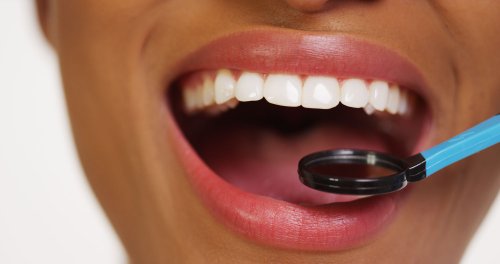 Le ulcere del cavo orale guariscono più rapidamente grazie ai lattobacilli