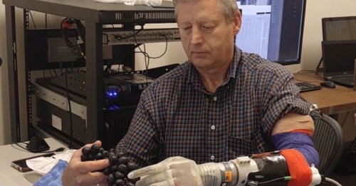High-tech neuroprosthetic ‘Luke’ arm lets amputee touch and feel again