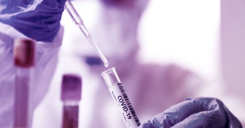 Coronavirus: desarrollan un método de detección más barato y eficaz
