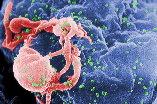 Viking DNA Reveals the Ancient Origins of an HIV-Fighting Gene Mutation