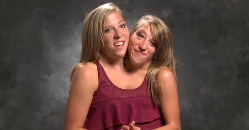 Conjoined Twins Abby and Brittany Hensel Are Elementary School Teachers
