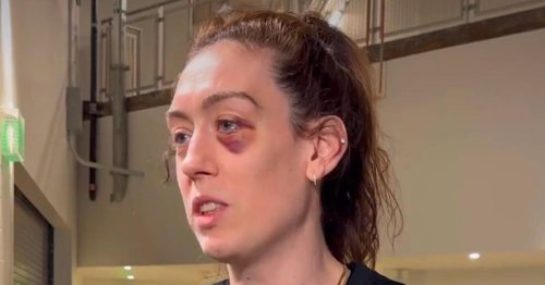 New York Liberty PF Breanna Stewart Sports a Nasty Black Eye on the Court