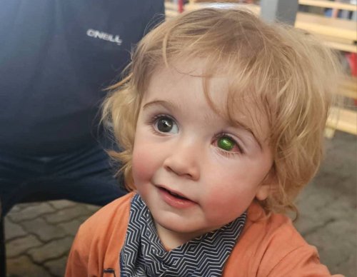 Un enfant perd un œil après un simple baiser, une histoire qui alerte sur un danger méconnu