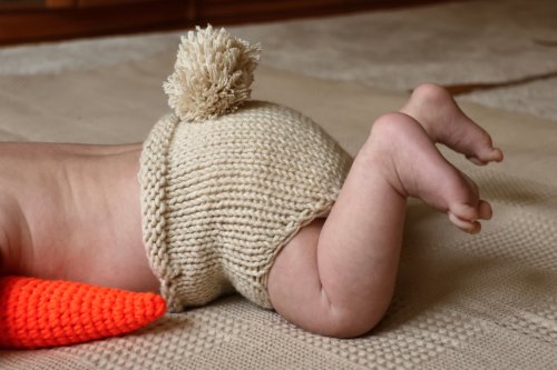 Ce bébé naît avec une vraie queue humaine de 12 cm. Des images rares !