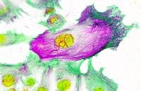 Scientists discover 'switch' that helps breast cancer spread around the body
