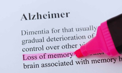 This sleeping pill reduces the accumulation of proteins associated with Alzheimer’s disease