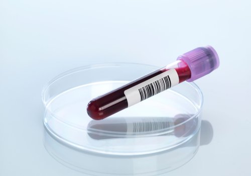 Cancer : bientôt une simple prise de sang pour repérer la maladie ?