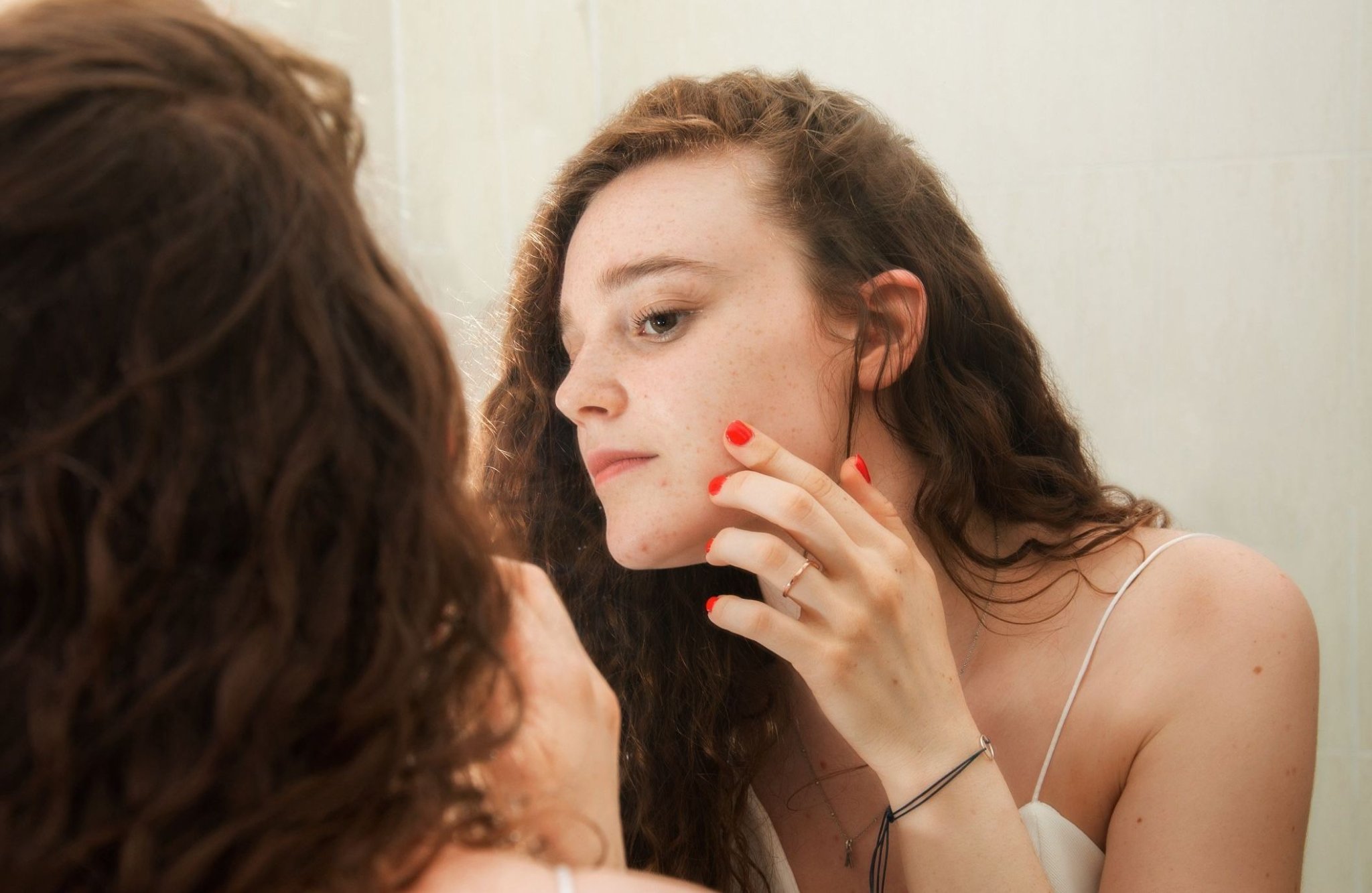 Qu’est-ce que la dermorexie, ce syndrome qui touche de plus en plus d’ados ?