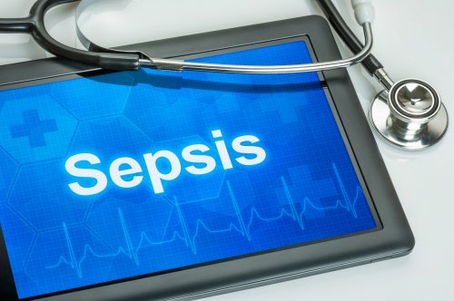 Emory awarded funding to test AI use in sepsis patients through precision medicine approach | Emory University | Atlanta GA