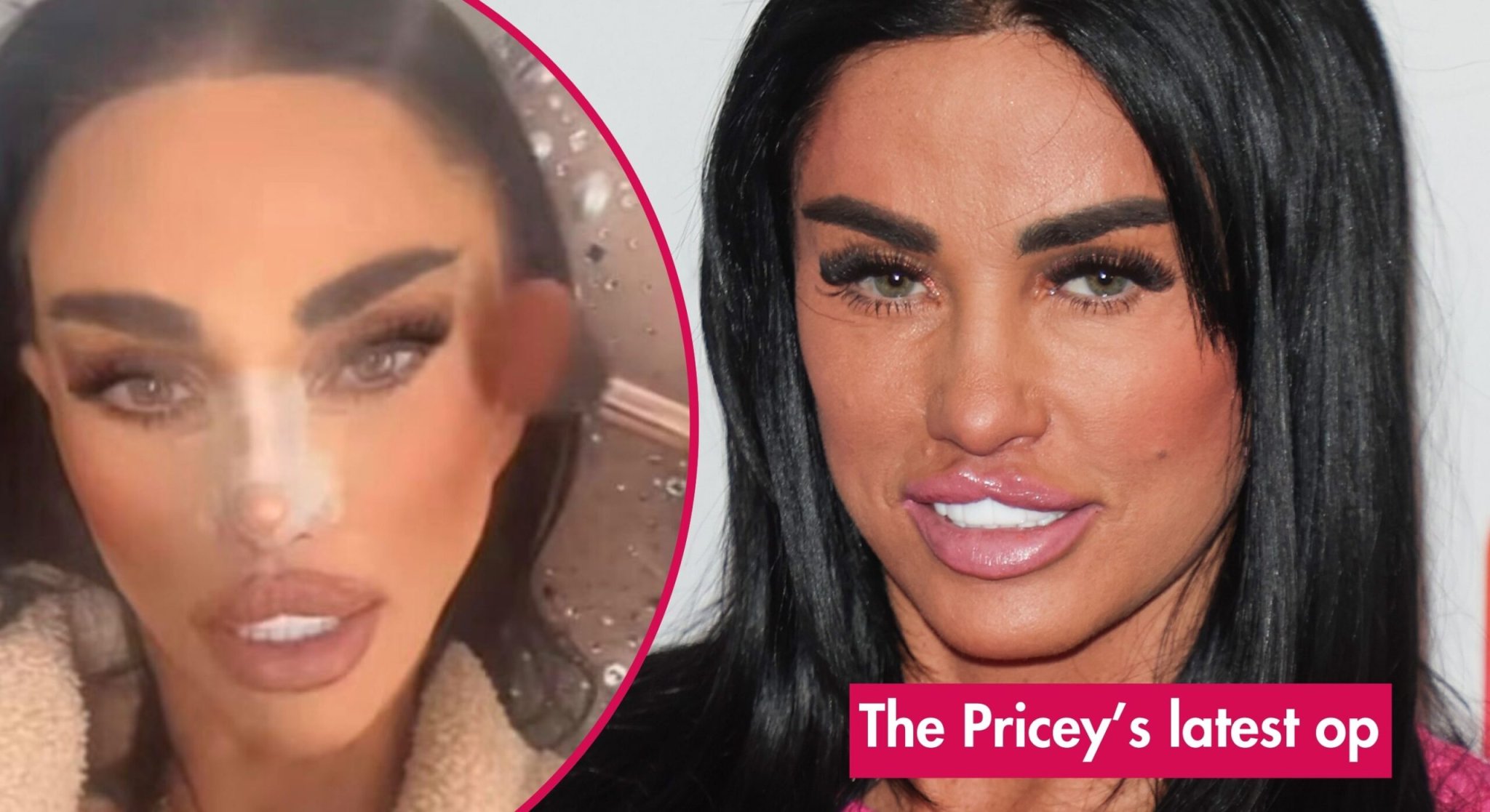 Katie Price shares gruesome picture of her bandaged face following more surgery: 'They needed tweaking'