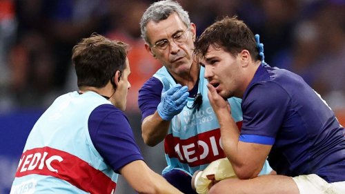 Rugby World Cup Daily: France rocked by suspected fractured jaw