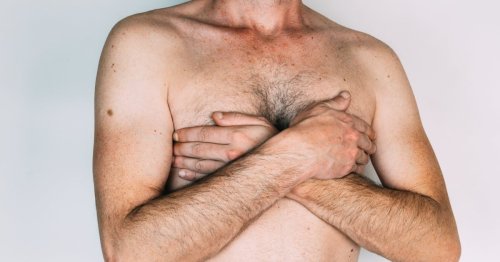 Männerbrüste: Was tun gegen Gynäkomastie? Ursachen und Behandlung