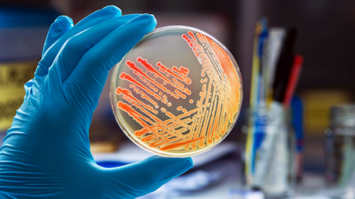 Hidden Bacteria Presents A Substantial Risk Of Antimicrobial Resistance In Hospital Patients
