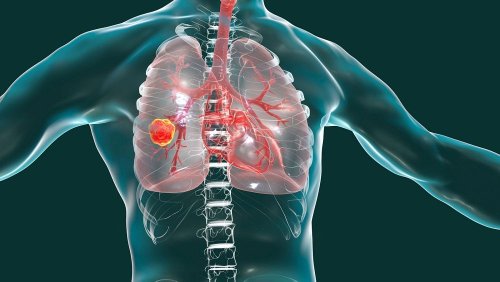 'We are gaining a better understanding’: Scientists uncover new method to stop lung cancer protein
