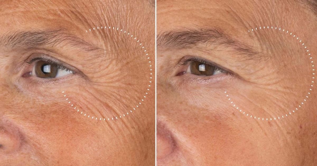 Medik8 'magic' peptide serum that 'smooths skin after one use' is 20% off