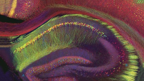 Scientists discover the on-off switch for human consciousness deep within the brain