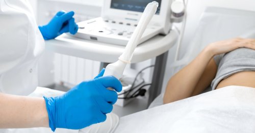 Vaginaler Ultraschall: Durchführung, Diagnosemöglichkeiten und Kosten