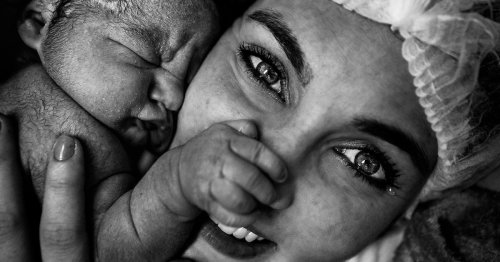 Geburt in Bildern: Die schönsten Geburtsfotos weltweit