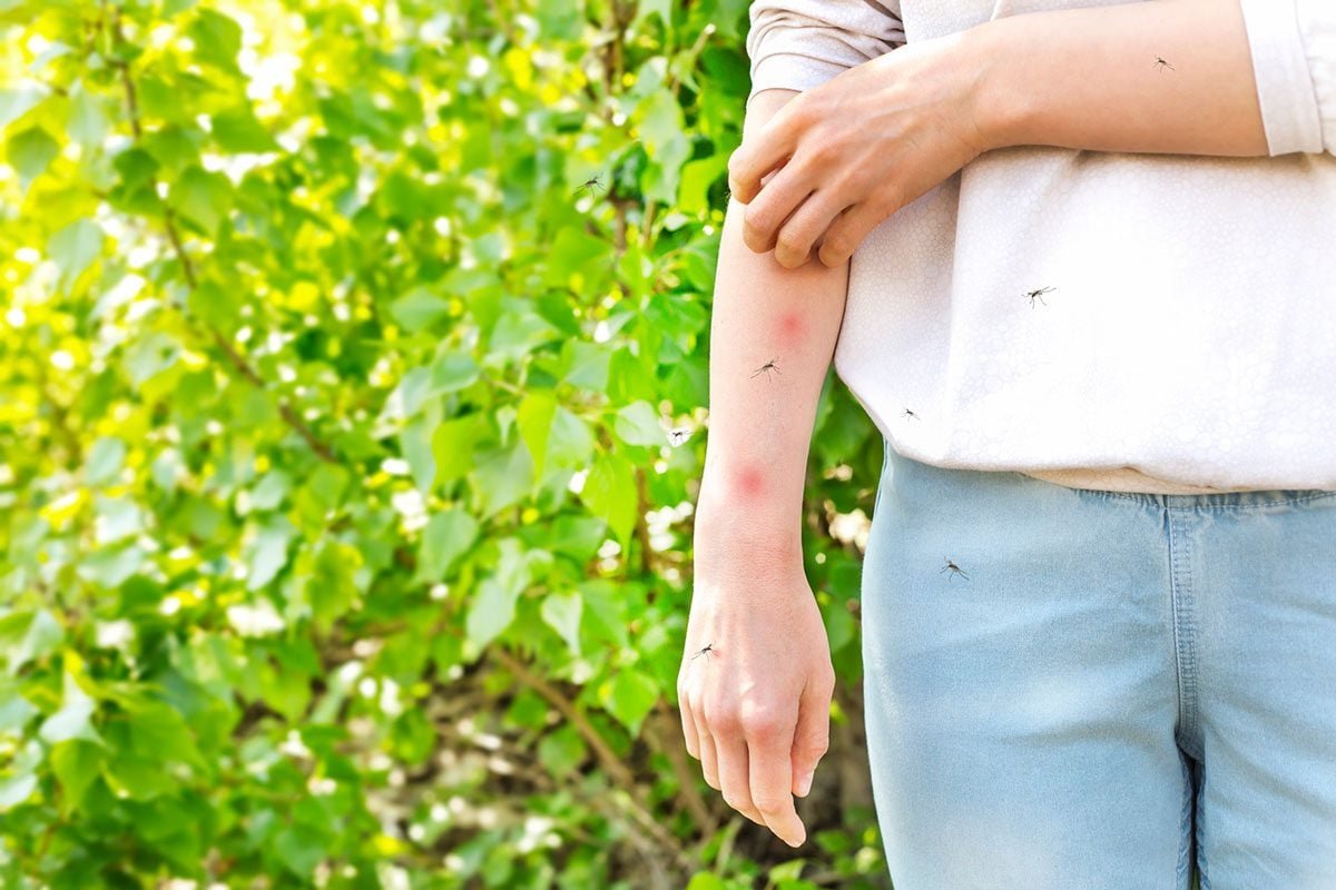 Unbelievable Hacks for Keeping Mosquitoes Away For Good