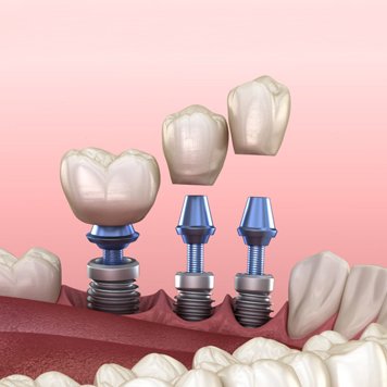 dentist - cover