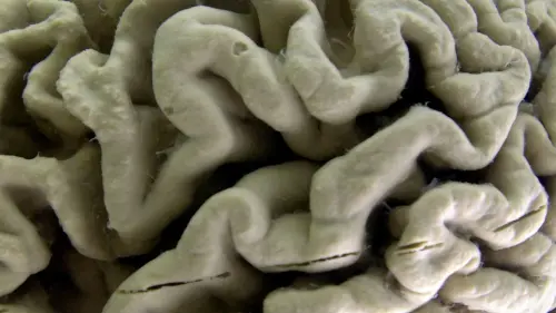 High Alzheimer's risk in healthy adults may be identified with this blood test