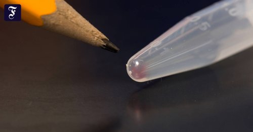 Durchbruch mit DNA-Speicher : Die Festplatte für die Ewigkeit