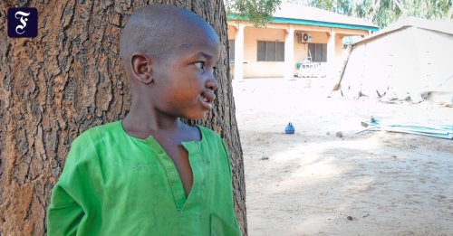 Interview zur Krankheit Noma: „Die zehn Prozent, die über­leben, werden häufig von ihren Familien versteckt“