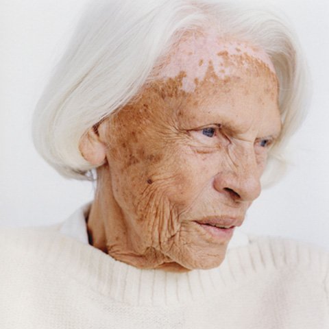 Peter Granser’s Powerful Portraits of Alzheimer’s Patients